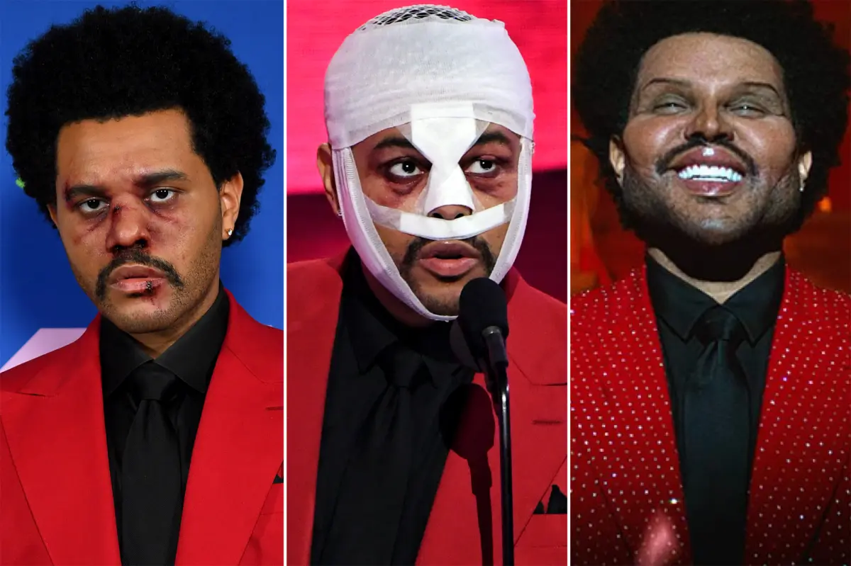 the weeknd plastic surgery